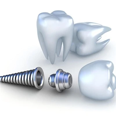 Hợp kim Titan cho cấy ghép y tế